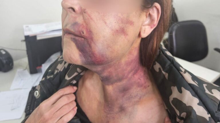 idosa-agredida-e1756494428206